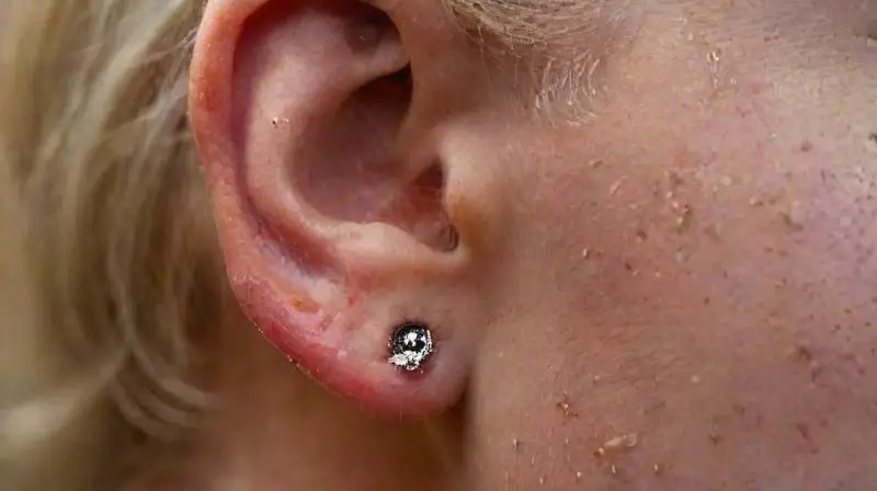 Close-up of pierced ear with jewelry