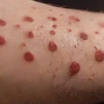 Close-up of tattooed forearms with contrast