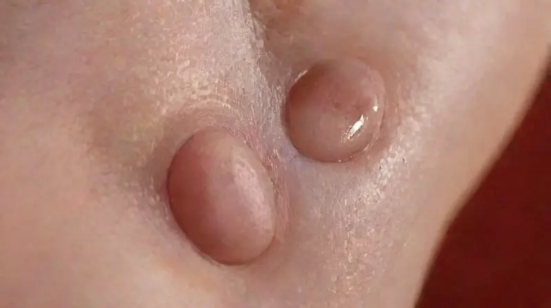 Close-up of fresh piercing and hygiene tools