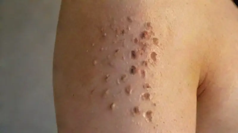 Arm with concealed tattoo under natural sunlight