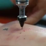 Close-up of tattooing process with detailed textures