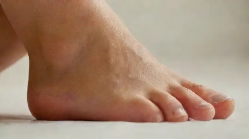 Close-up of ankle with piercing detail