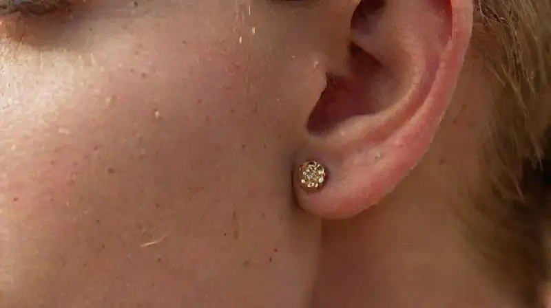 Close-up of healing pierced earlobes