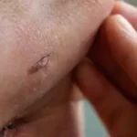 Close-up of ear piercing workshop scene