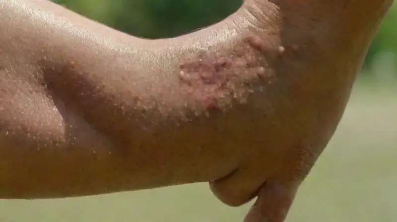 Fair-skinned person with watercolor tattoos outdoors